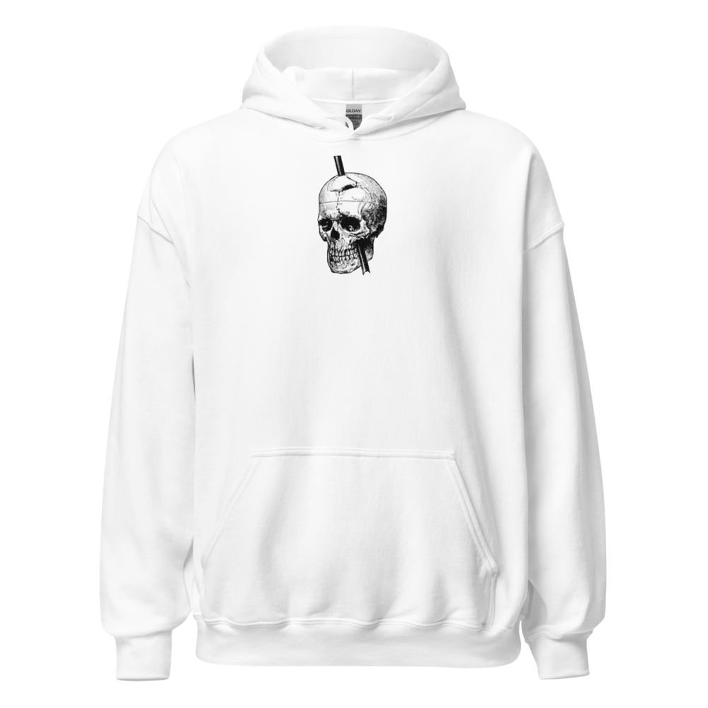 Phineas Gage Skull