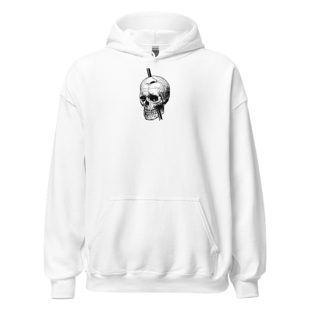 Phineas Gage Skull