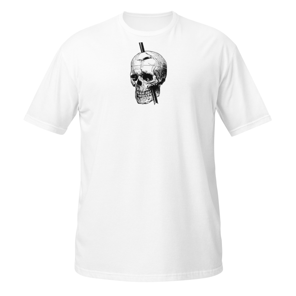 Phineas Gage Skull